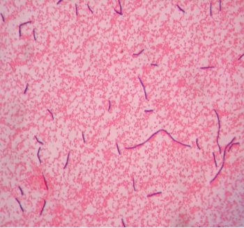 GRAM STAIN – Laboratory Exercises in Microbiology