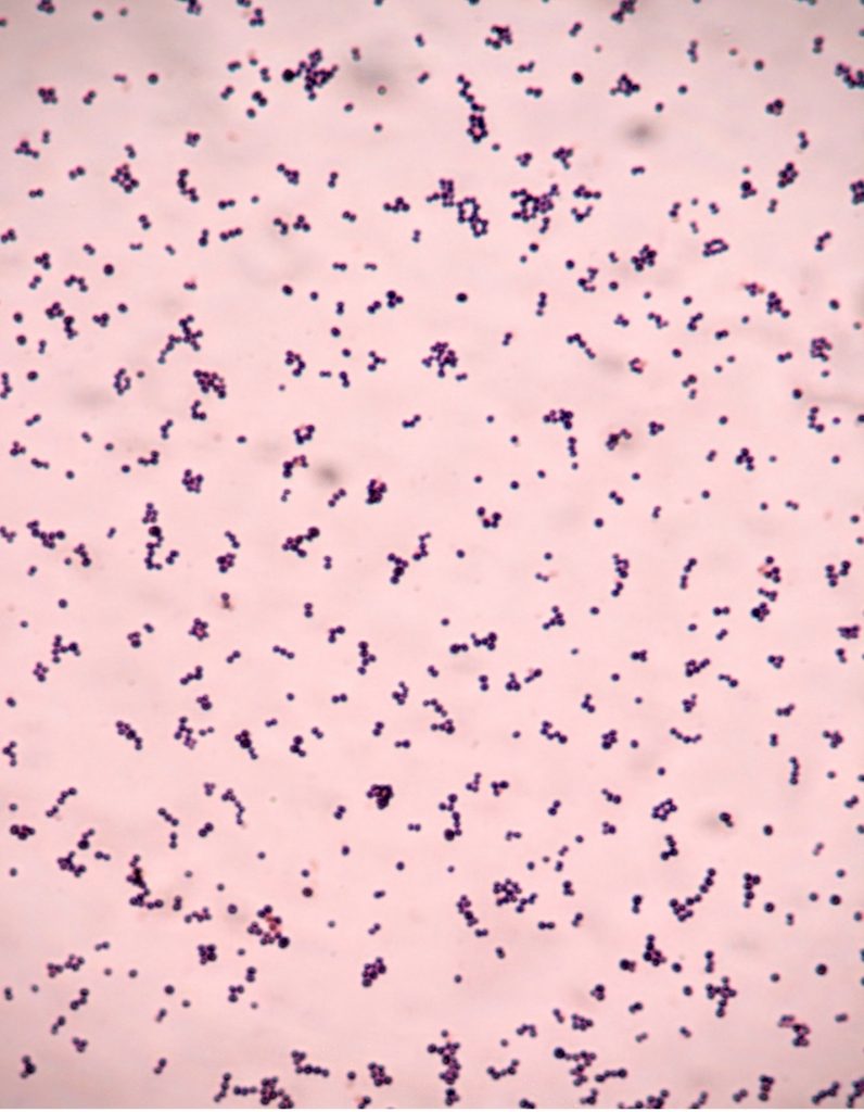 GRAM STAIN – Laboratory Exercises in Microbiology