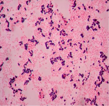 GRAM STAIN – Laboratory Exercises in Microbiology