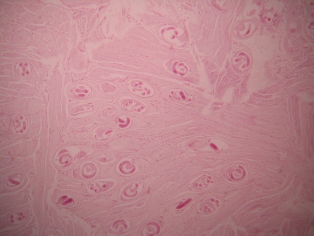 Trichinella spiralis parasite 40X total magnification