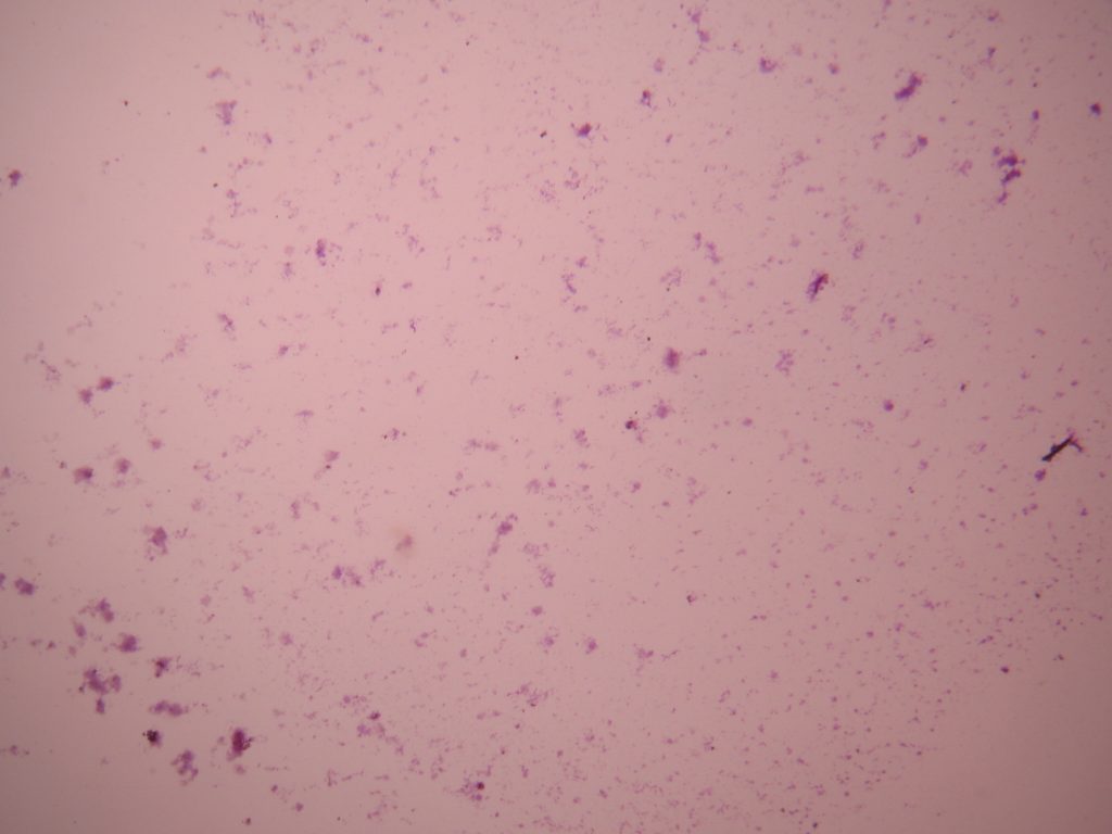 Bacteria from Mouth 40X total magnification