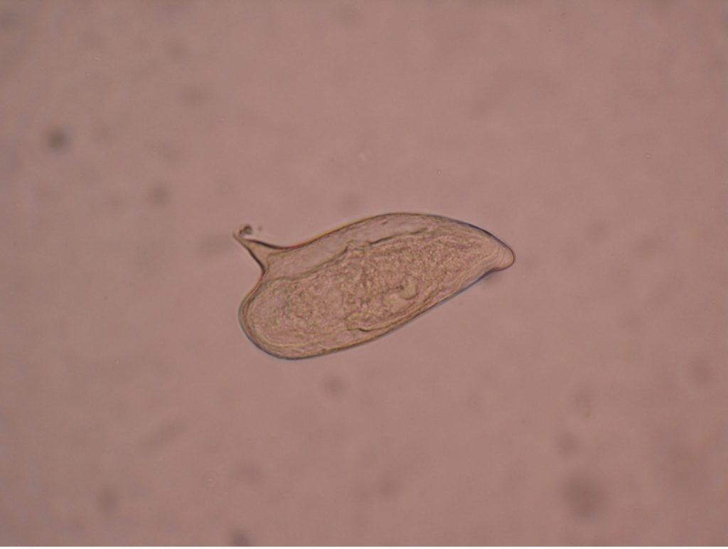 Schistosoma mansoni ovum