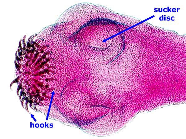 Taenia solium scolex