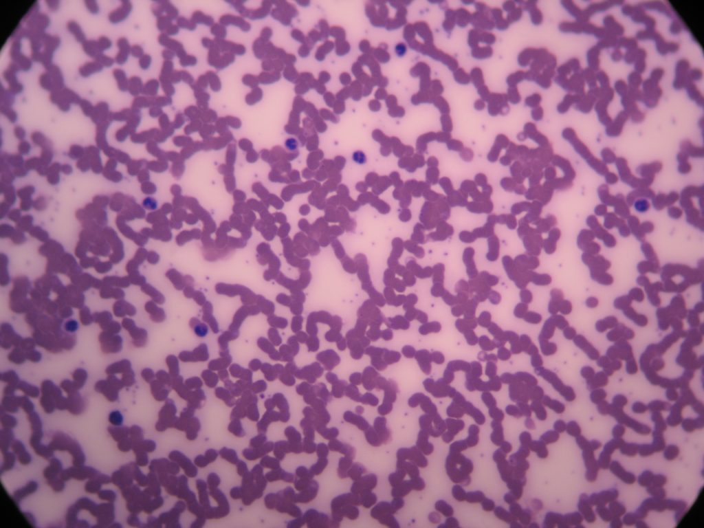 Human Blood Smear 400X total magnification