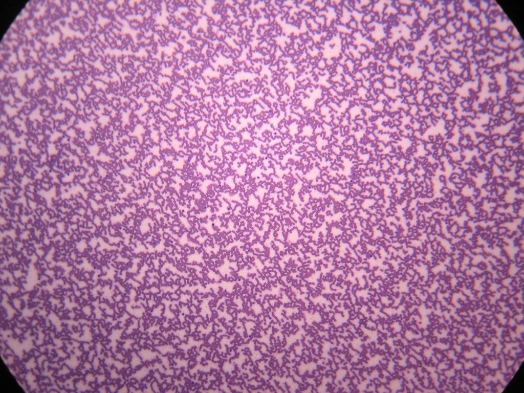 Human Blood Smear 100X total magnification