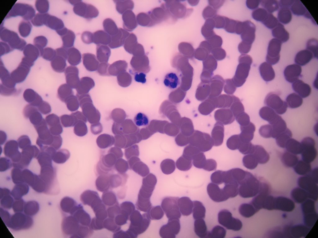 Human Blood Smear 1,000X total magnification