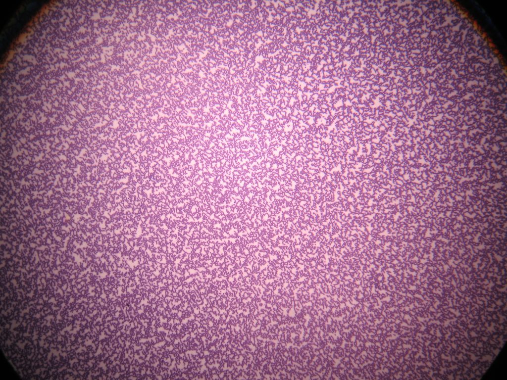 Human blood smear 40X total magnification