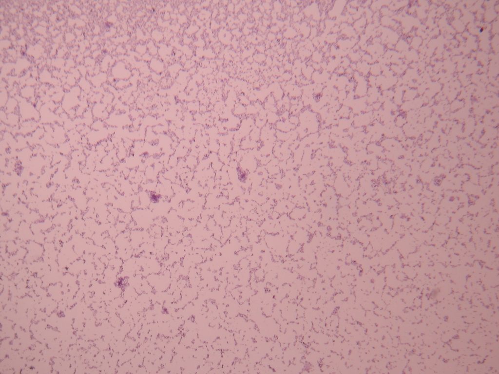 Budding Yeast 40X total magnification