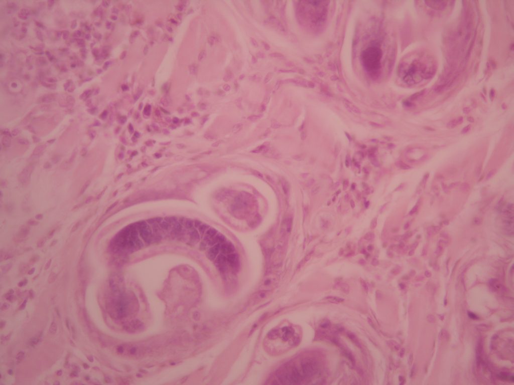 Trichinella spiralis parasite 400X total magnification