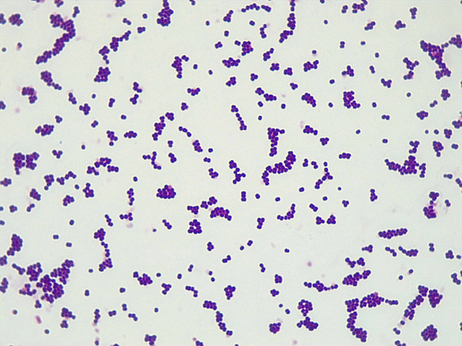 Gram-Positive Cocci