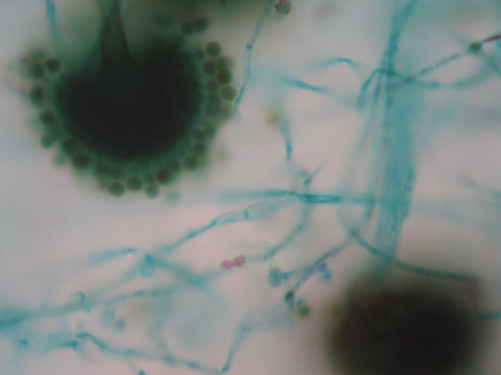 Mold 1,000X total magnification