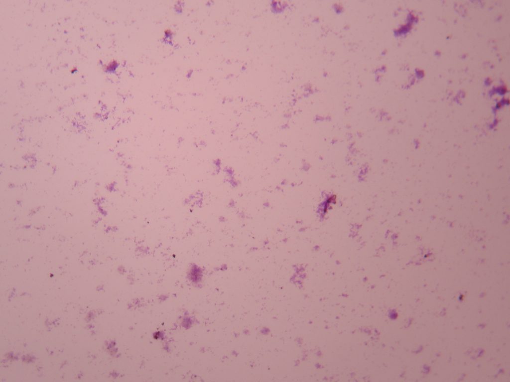 Bacteria From Mouth 100X total magnification