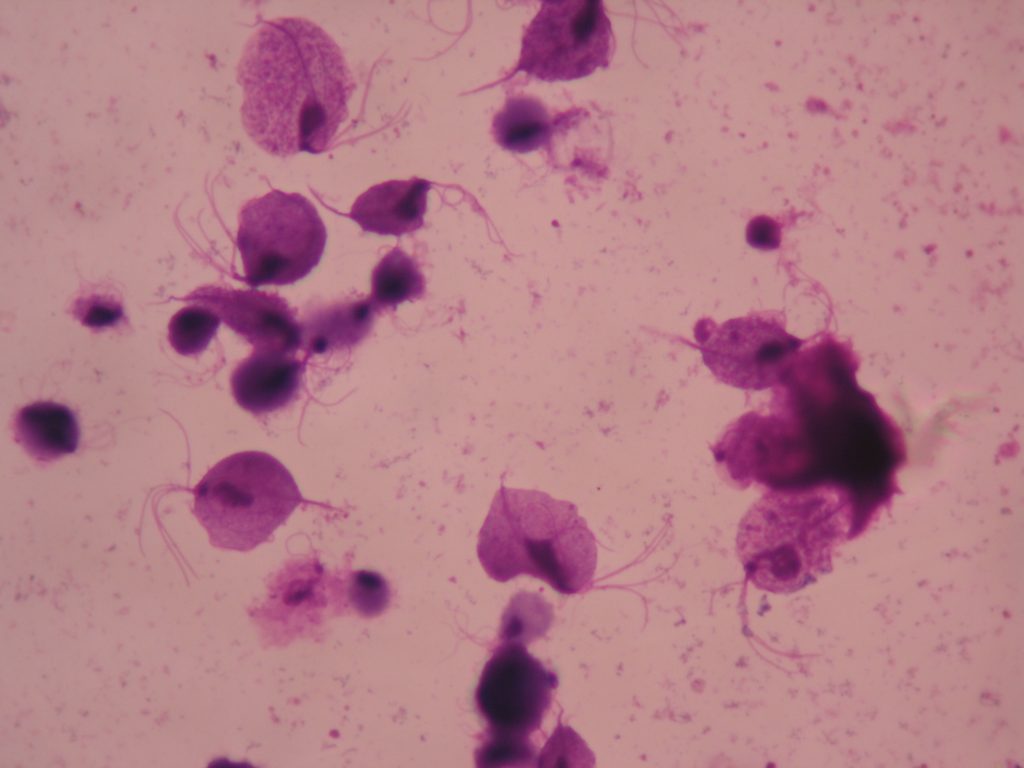 Trichomonas vaginalis parasite 1,000X total magnification
