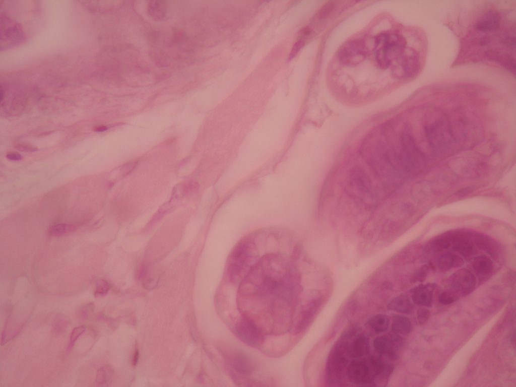 Trichinella spiralis parasite 1,000X total magnification