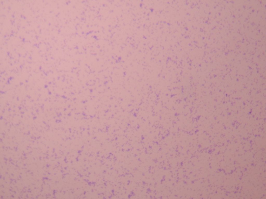 Bacteria Gram Positive Cocci 40X total magnification
