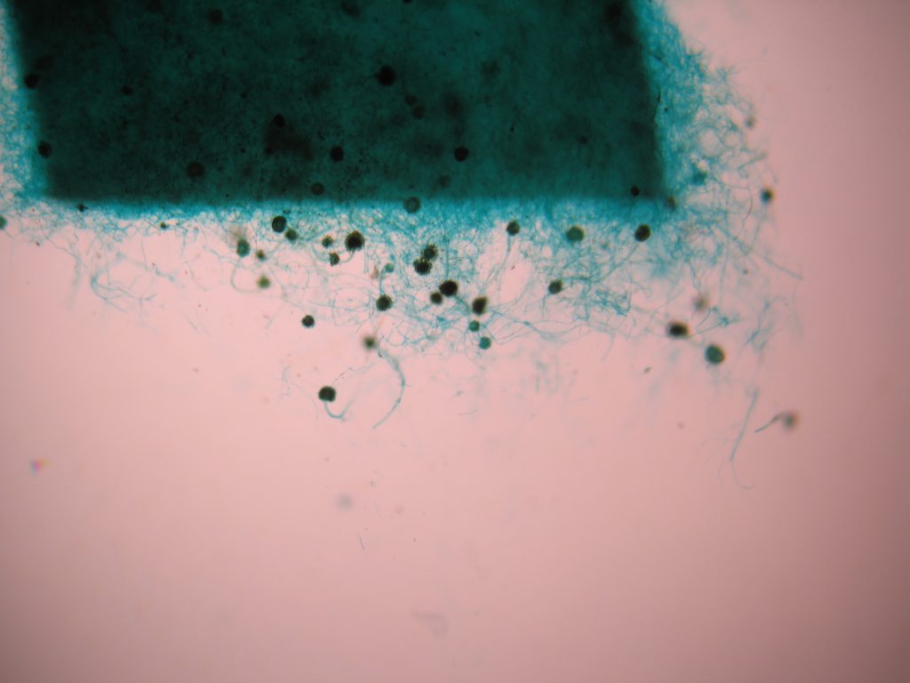 Mold 40X total magnification