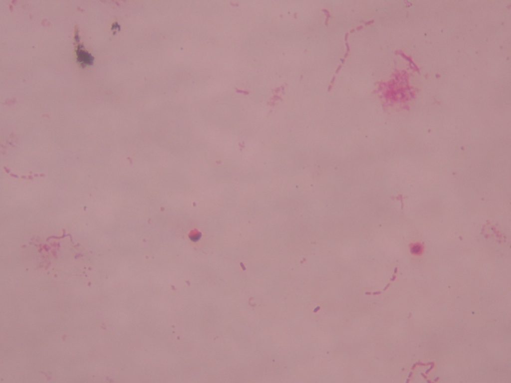 Stagnant Water Bacteria 400X total magnification