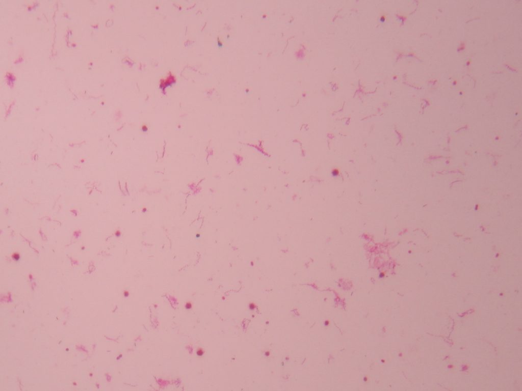 Stagnant Water Bacteria 100X total magnification