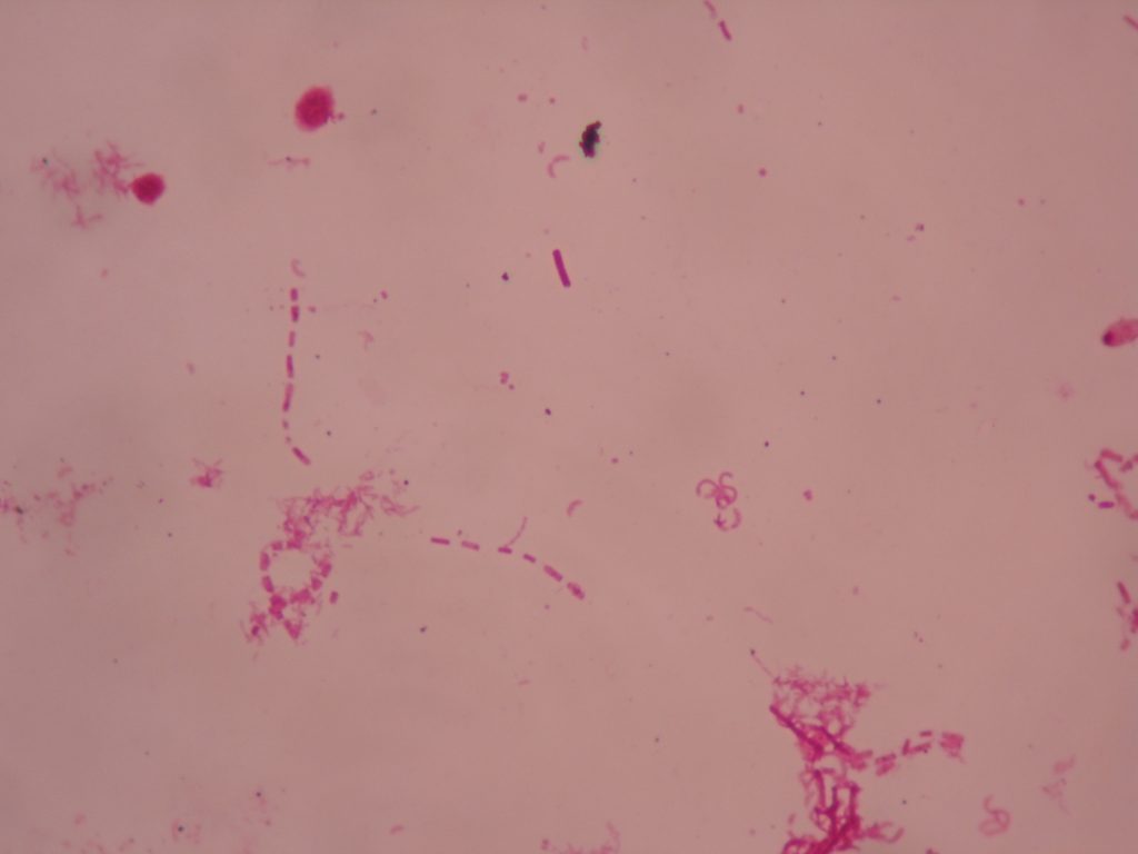 Stagnant Water Bacteria 1,000X total magnification