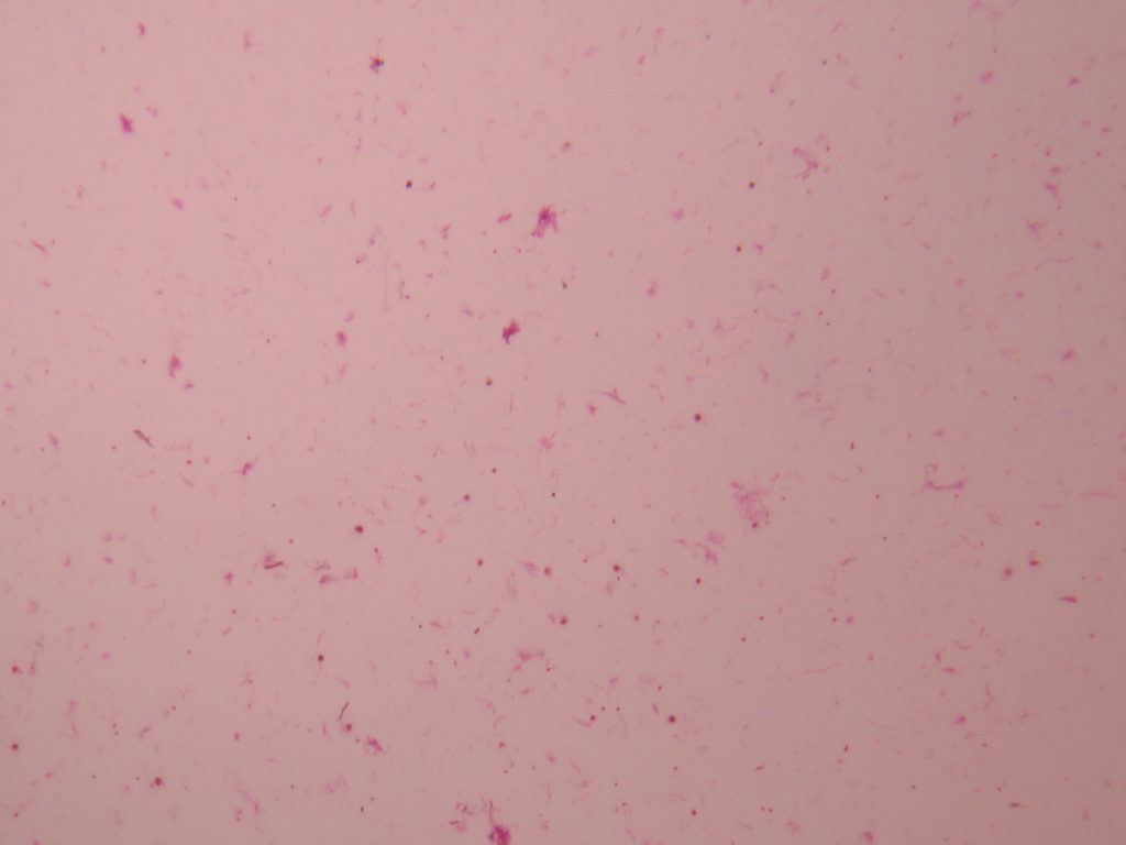 Stagnant Water Bacteria 40X total magnification