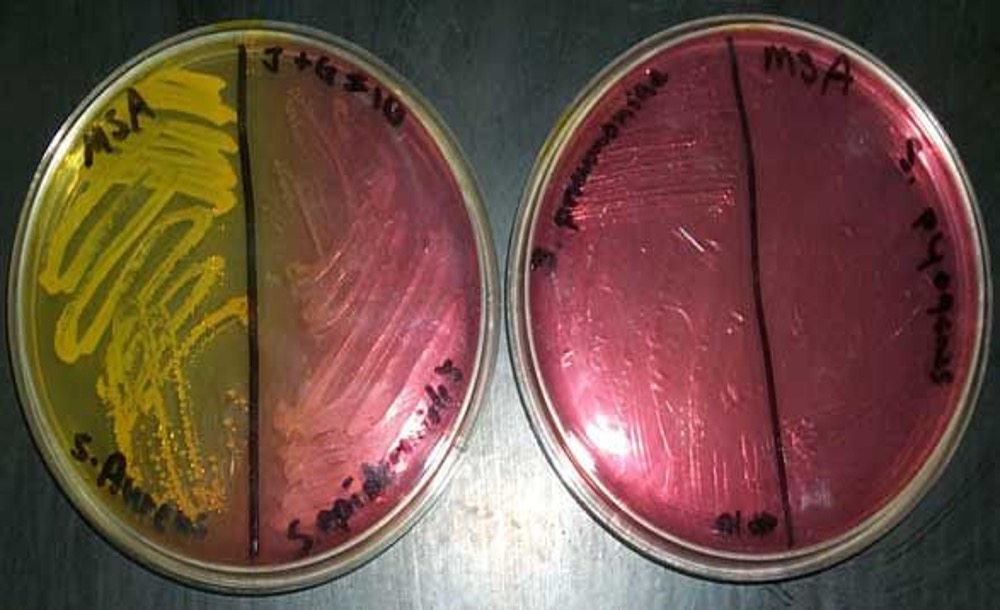 Mannitol Salt Agar