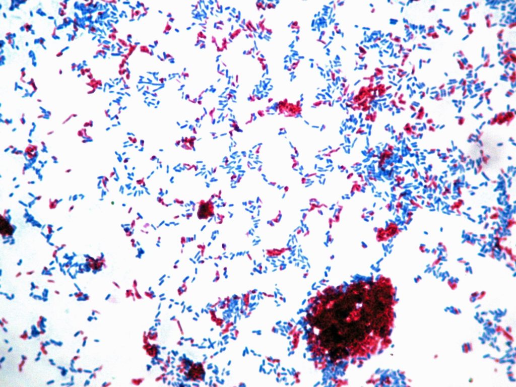 acid-fast stain showing pink bacilli and blue bacilli bacteria
