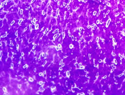 Negative or capsule stain