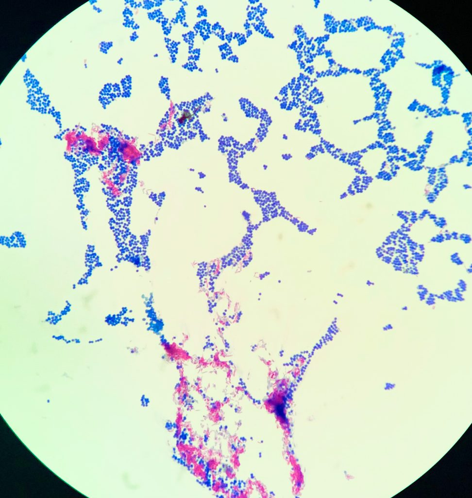 Acid-Fast Stain image