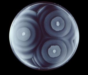 Image of Petri plate