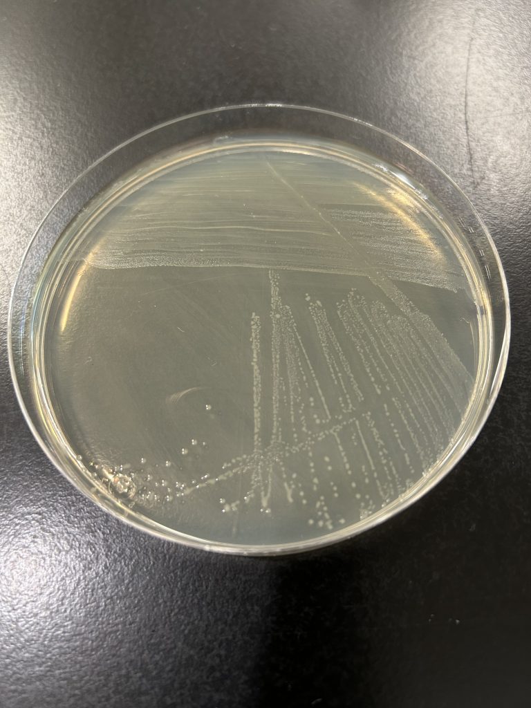 Group C Streptococcus colony color