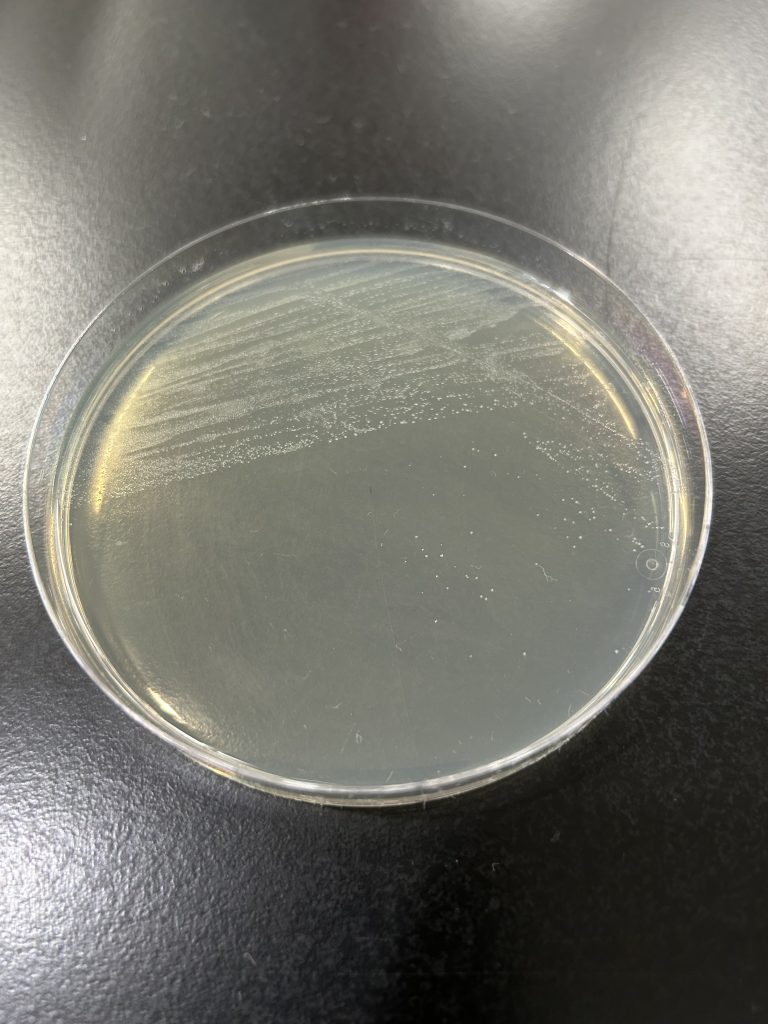 Streptococcus sanguinis colony color