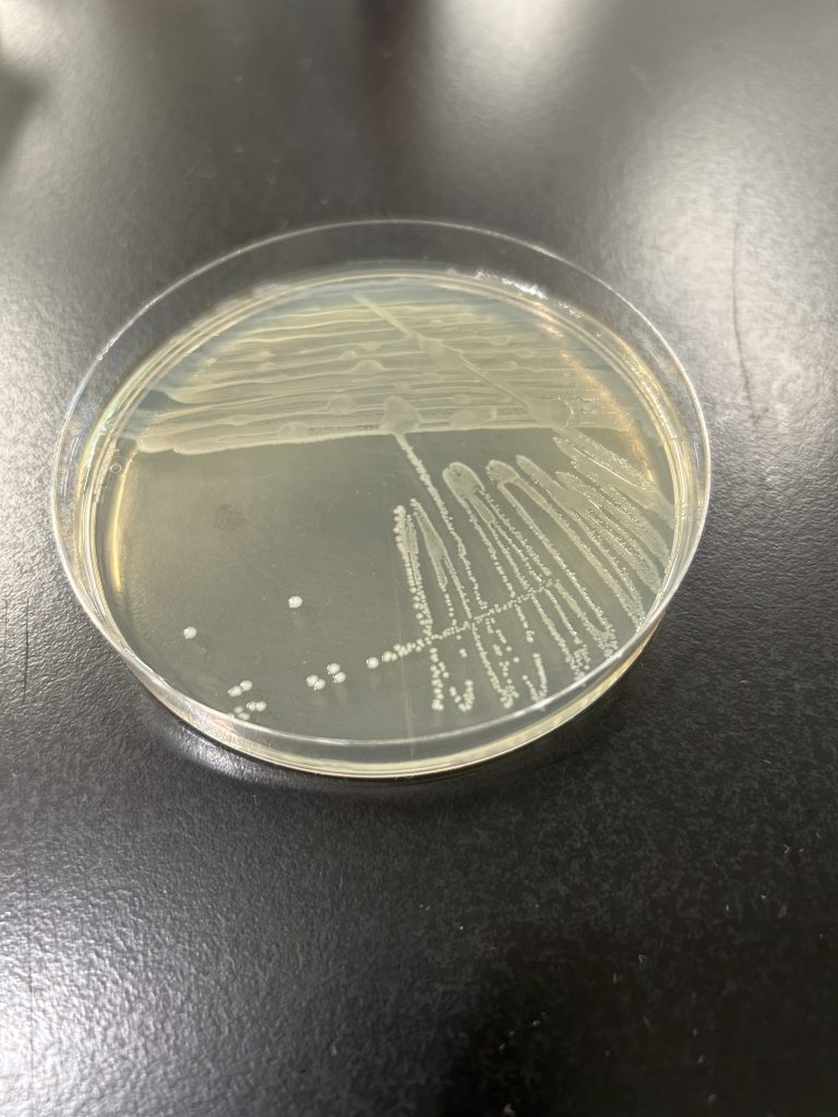 Enterococcus faecalis colony color