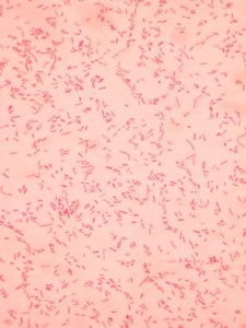 E. coli simple stain using safranin.