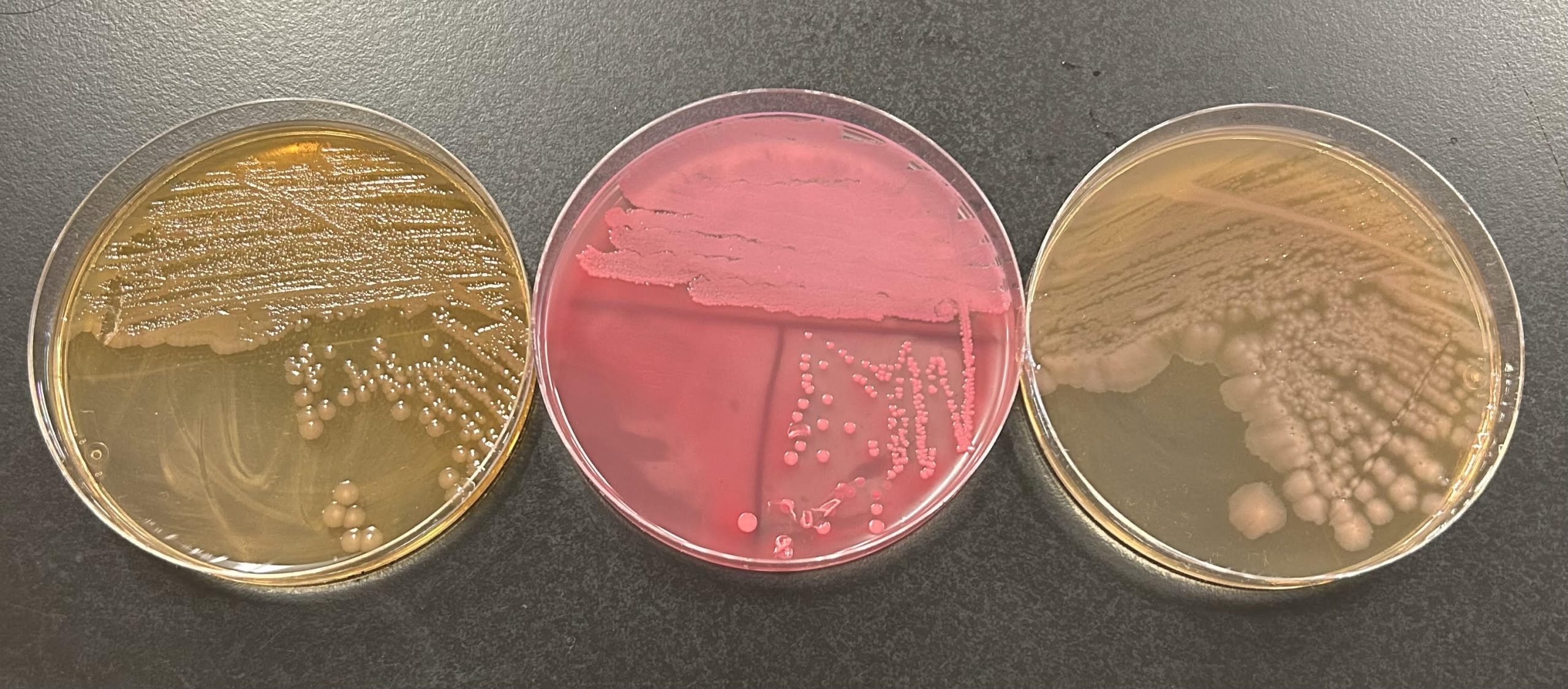 3 MacConkey agar plates side by side. The midle plate has hot pink colonies and is positive for lactose fermentation. The 2 plates to the sides do not have hot pink colonies and are negative for lactose fermentation.